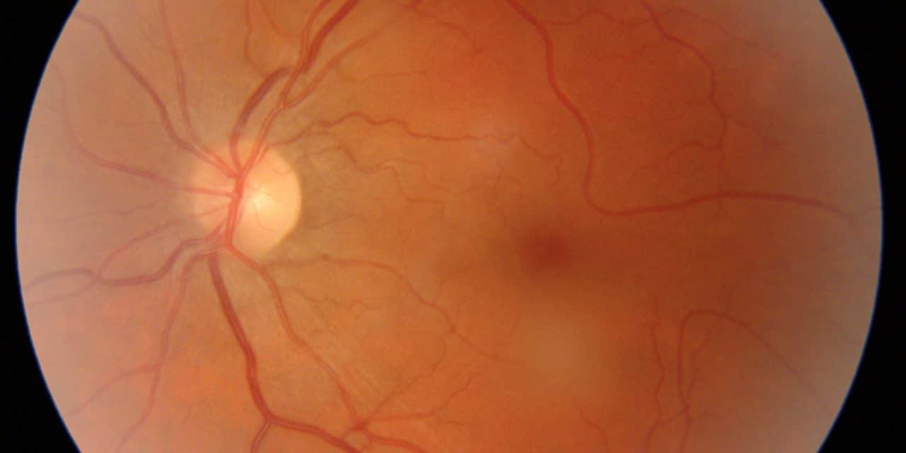 Occhi e cattiva digestione