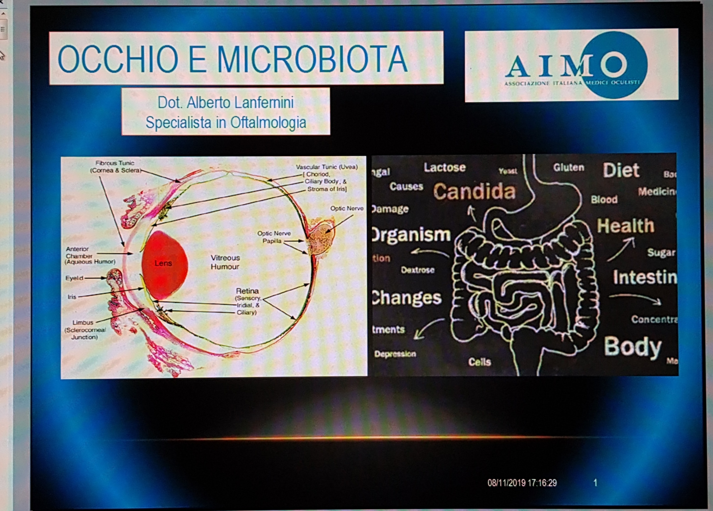 Occhio e microbiota Occhio e microbiota