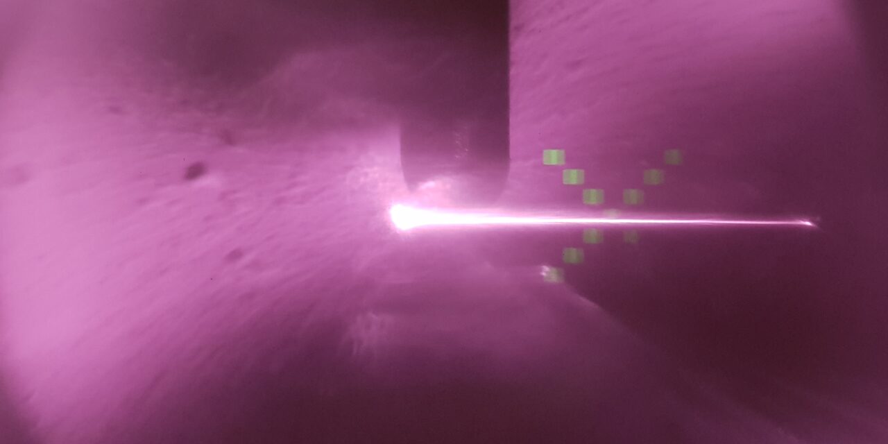 OCT il raggio laser per le maculopatie