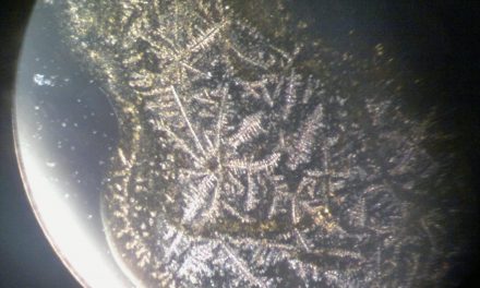 Siero autologo collirio (autosiero): differenza con siero collirio da donatore e siero cordonale