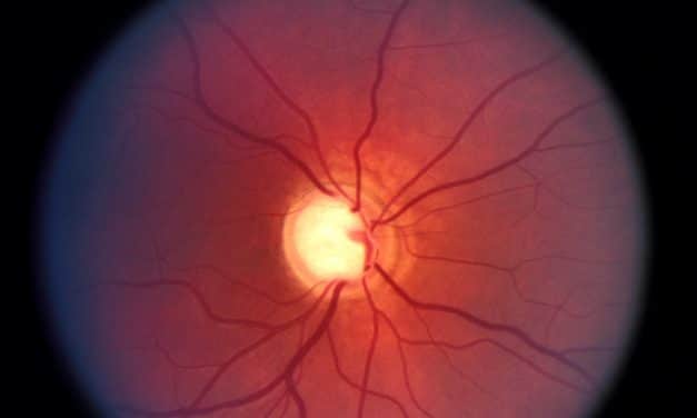 Integratori per pressione oculare alta e glaucoma
