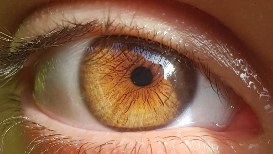 Stress e occhi: disturbi oculari da stress