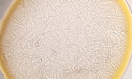 Occhio secco e alfa/beta diversità microbiota intestinale