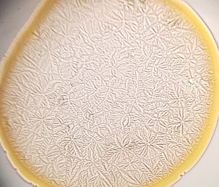 Occhio secco e alfa/beta diversità microbiota intestinale