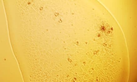 Sonno e occhio secco