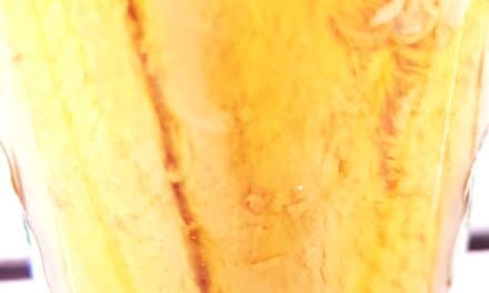 Vitamina D e salute degli occhi