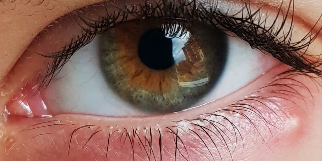 Blefariti, orzaioli e calazi cura e prevenzione