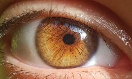 Come curare gli occhi stanchi