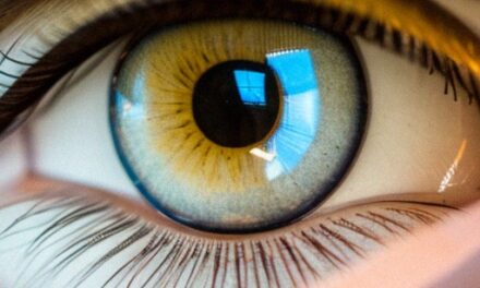 Blefarite cronica e calaziosi ricorrente